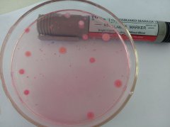 ATP熒光檢測器識別細(xì)菌的優(yōu)缺點